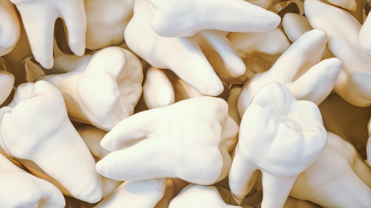 Dental Crowns: What They Are, Types, Benefits, and When You Need One