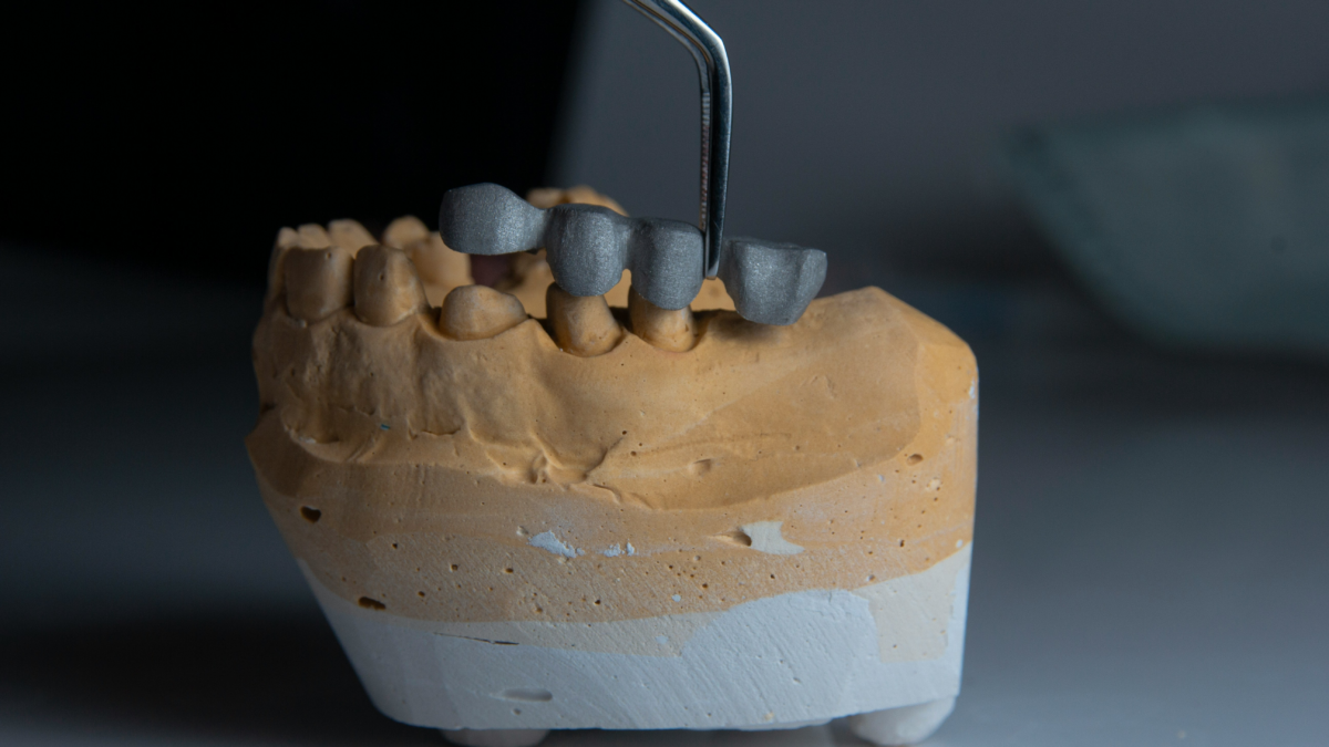 How Is Root Canal Treatment Performed?