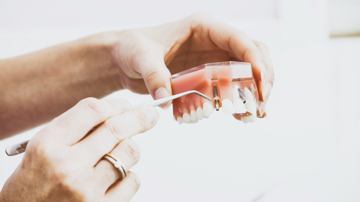Dental Implants: A Permanent Solution for Missing Teeth