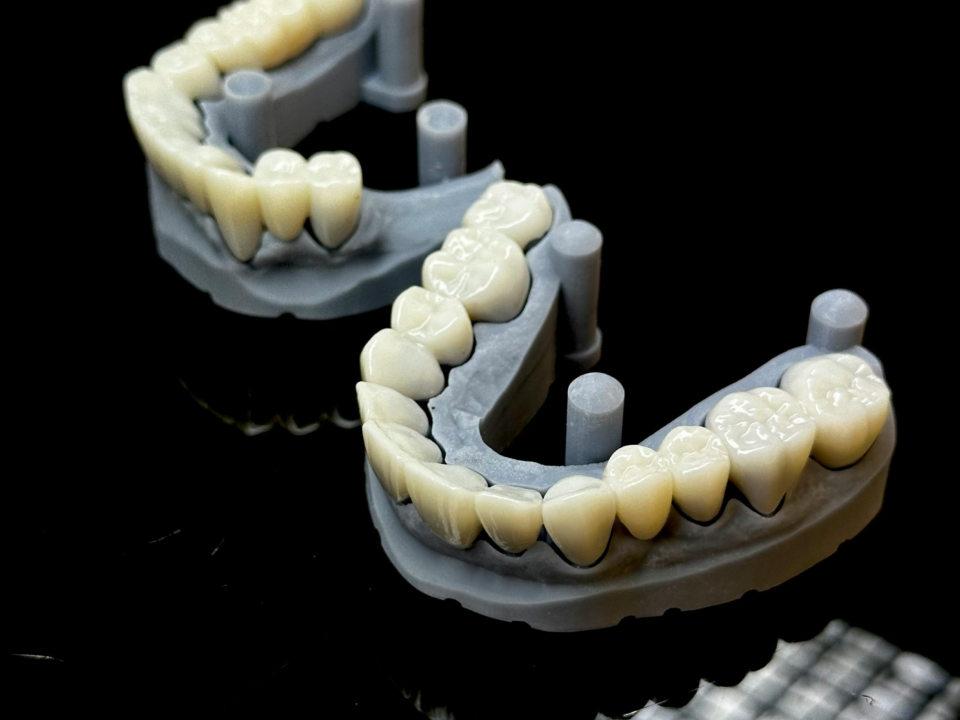Zirconium Crowns in Turkey: A Natural and Durable Solution for a Confident Smile