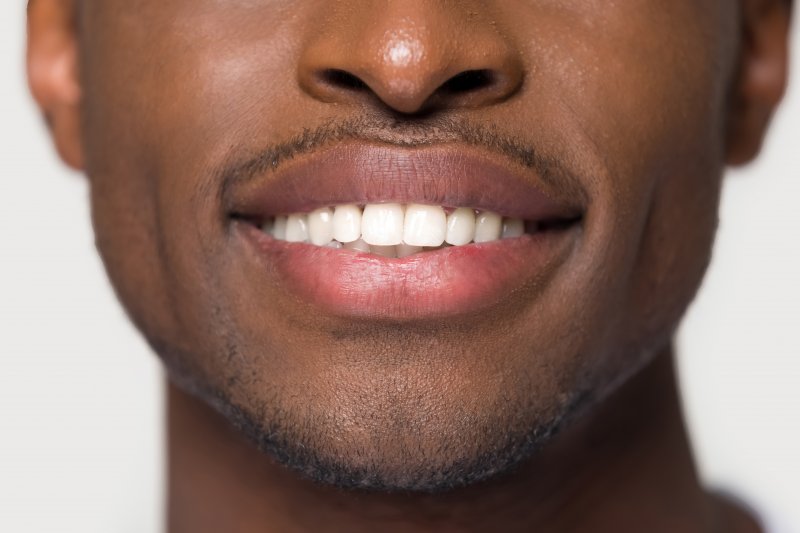 Are Dental Veneers Worth It? A Comprehensive Pros and Cons Analysis