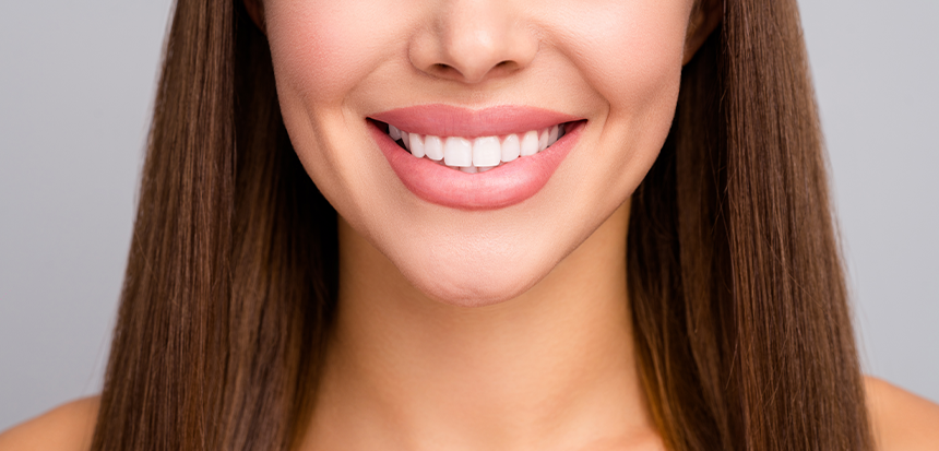 Transform Your Confidence with a Hollywood Smile and Dental Veneers