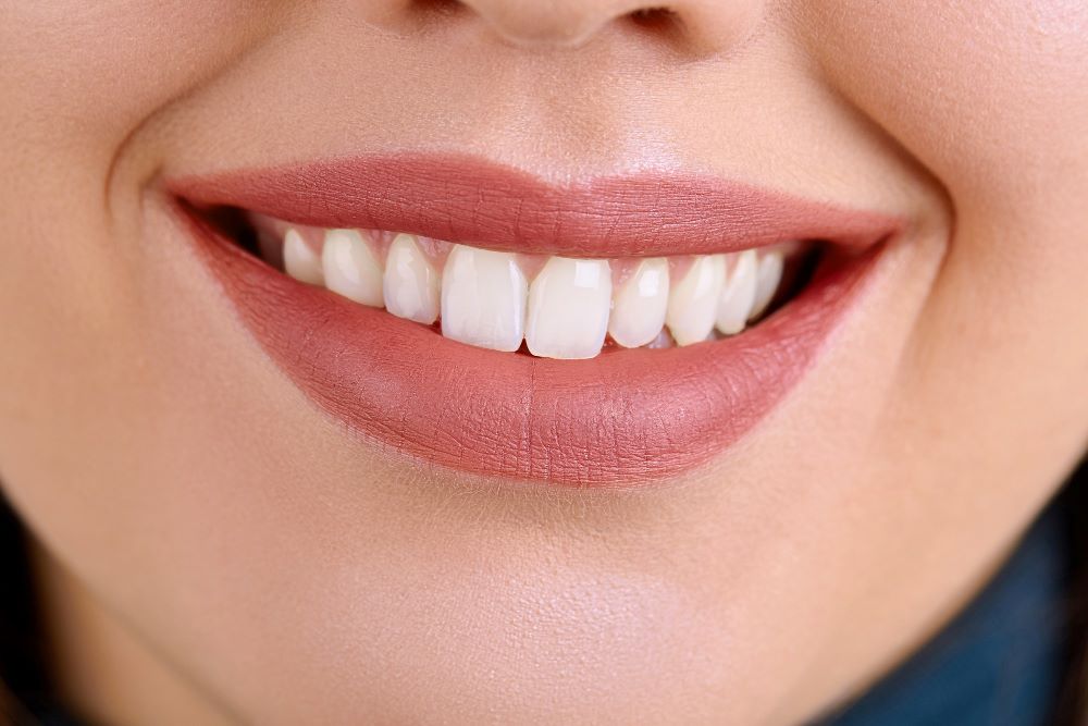 Achieving the Hollywood Smile: The Role of Dental Implants